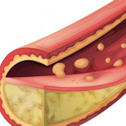 Colesterolo: cibi da evitare nella dieta